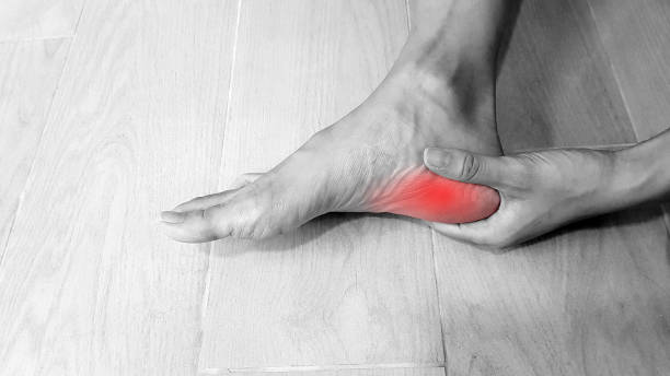 chronic plantar fasciitis